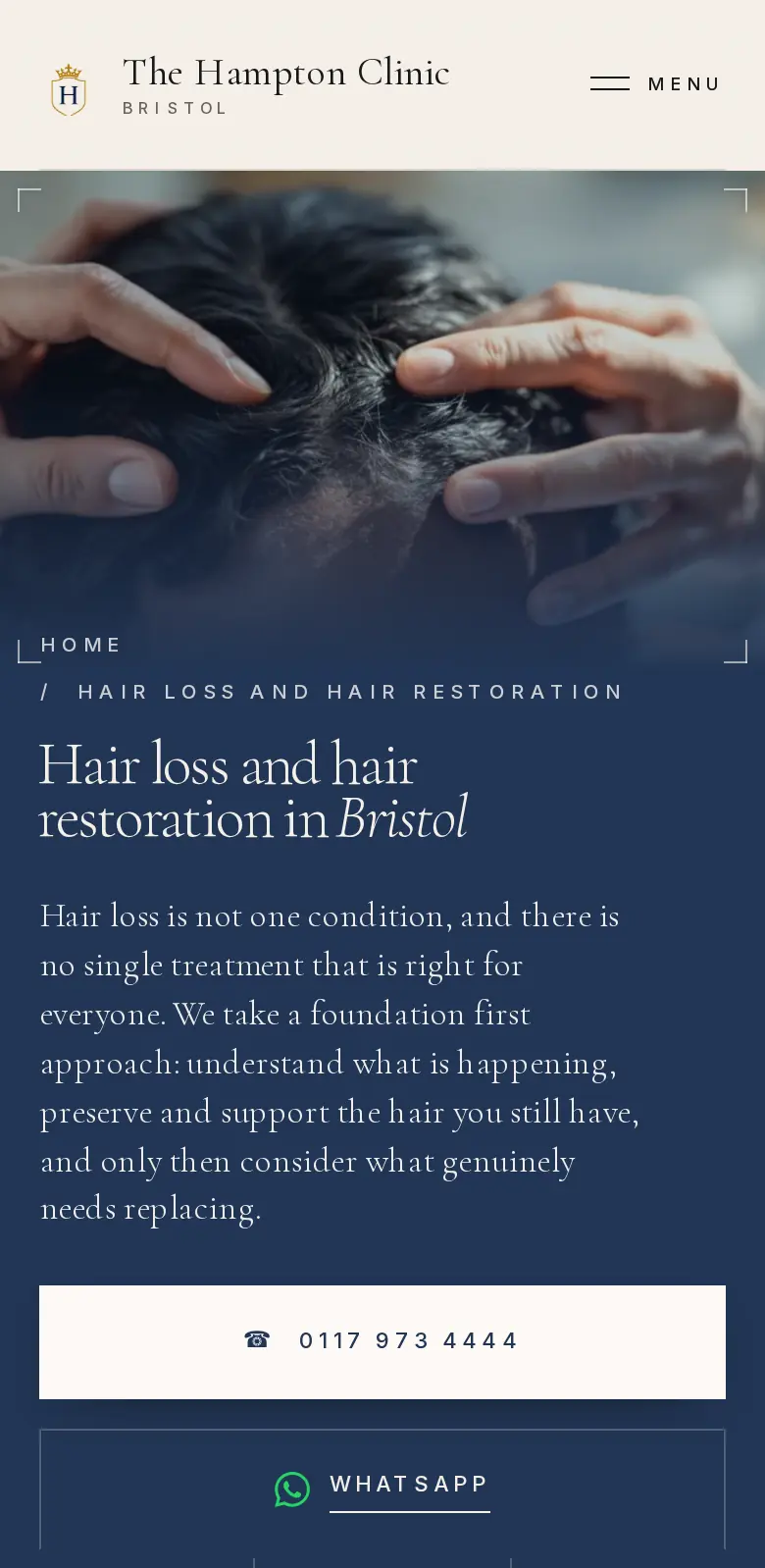 The hair loss page on a phone, with call and WhatsApp in the first screen